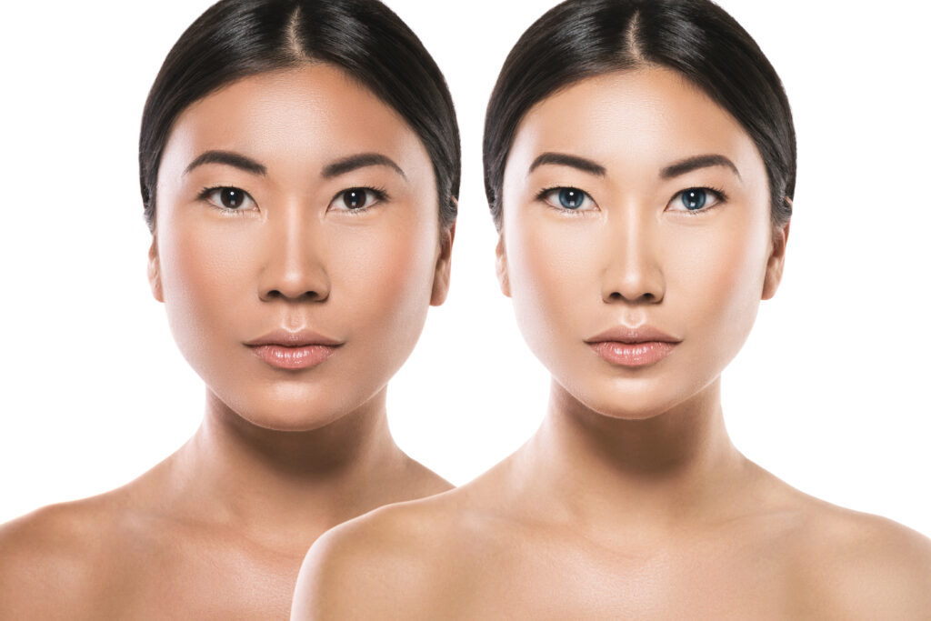 Transformation of Asian woman. Result of plastic surgery or retouch.